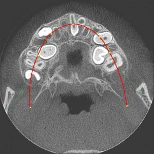 CBCT axial